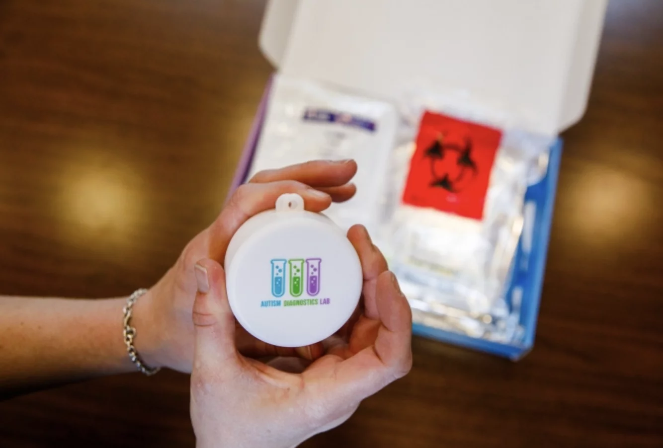 簡單尿液檢測將自閉症診斷從行為觀察轉向生物標記 1