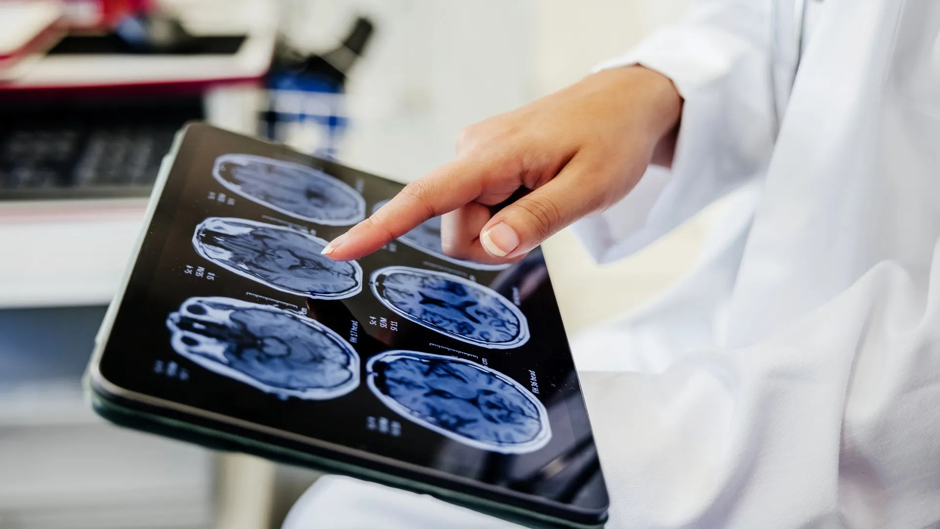 Chinese Smart Chip Reconstructs Brain Structure Up to 478x Faster Than NVIDIA A100 GPU 1